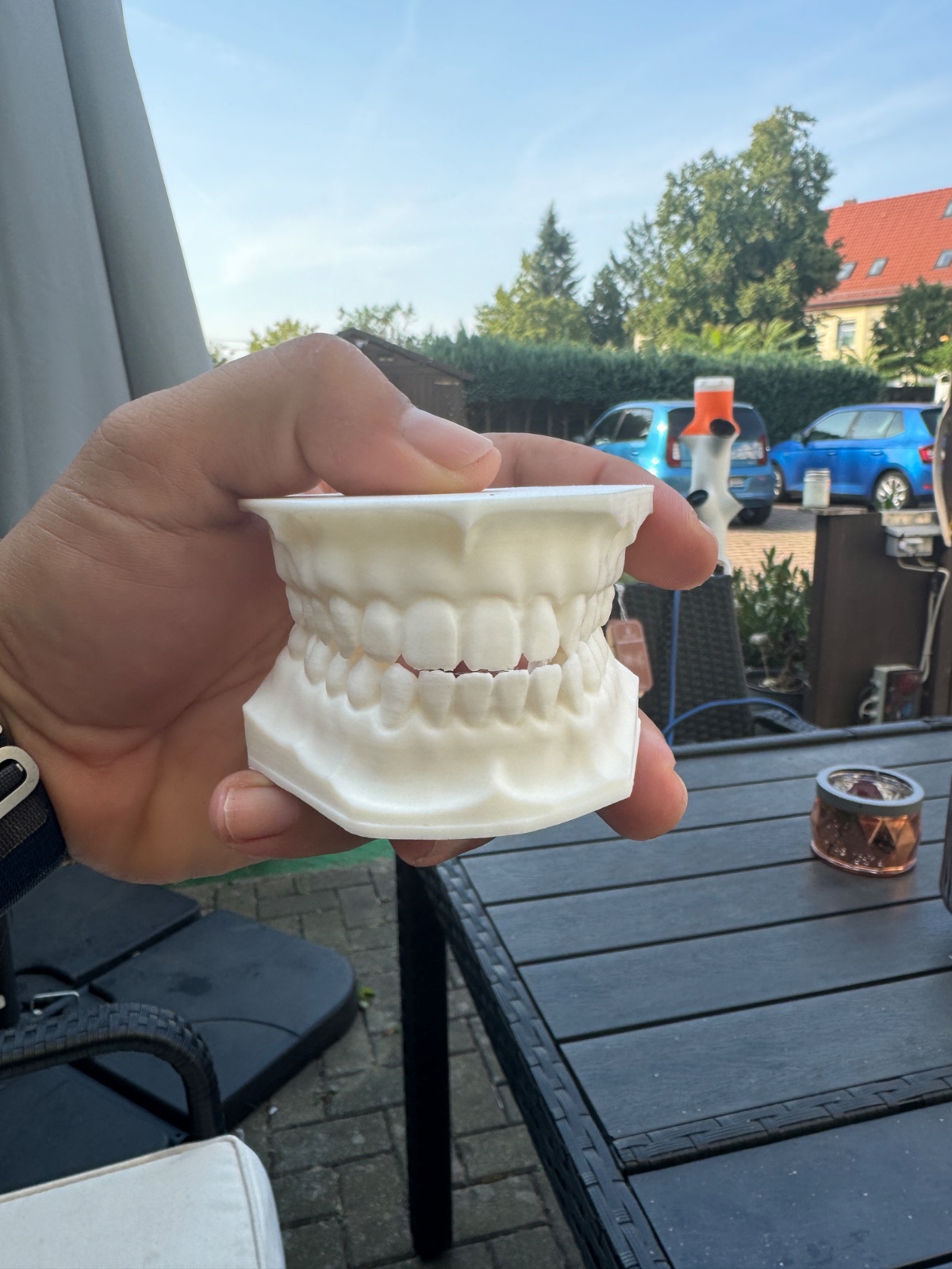 3D-gedrucktes Dentalmodell mit Ober- und Unterkiefer
